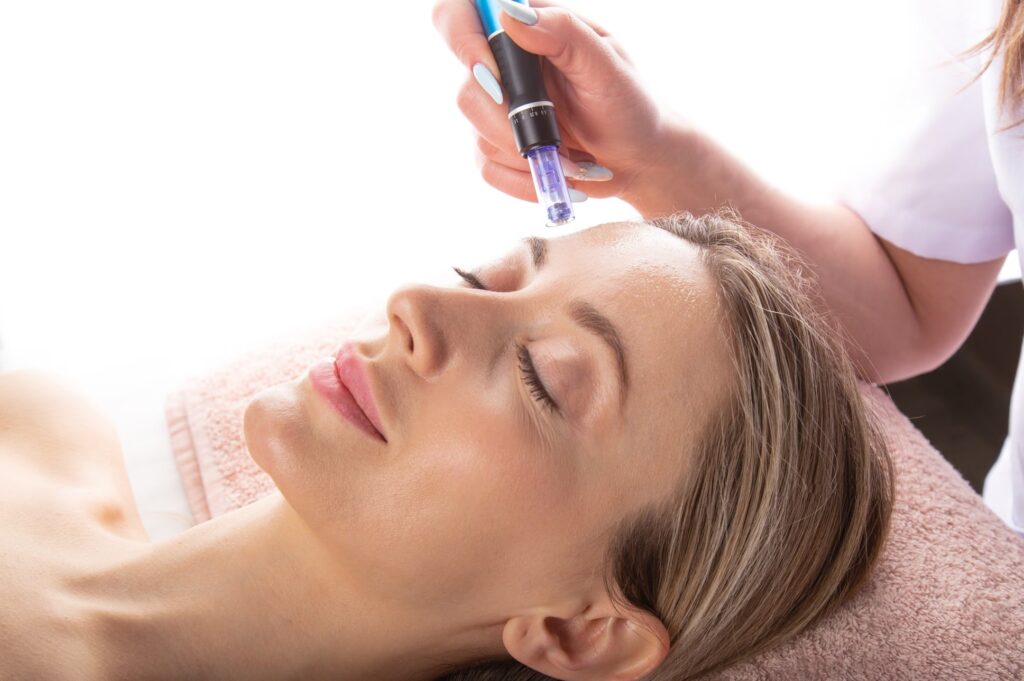 Microneedling 7 Microneedling converted 1
