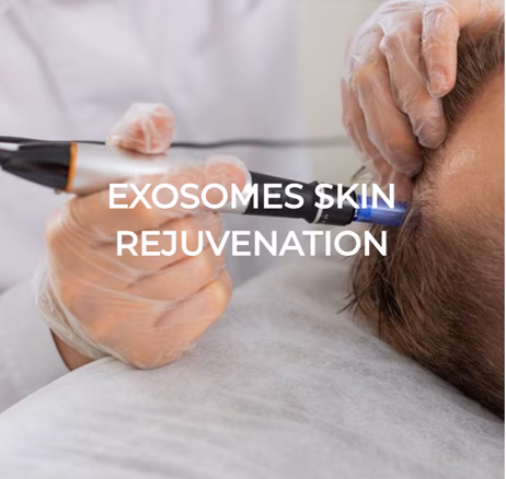 Microneedling 9 Picture4 converted
