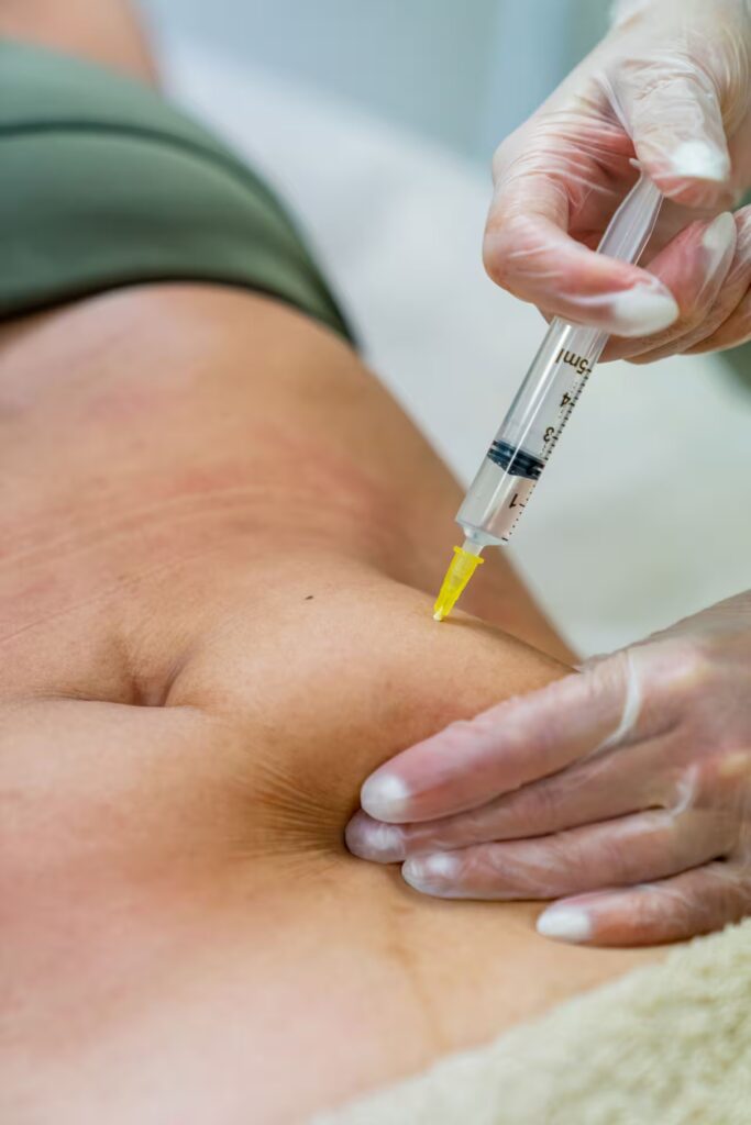 fat dissolving treatment converted