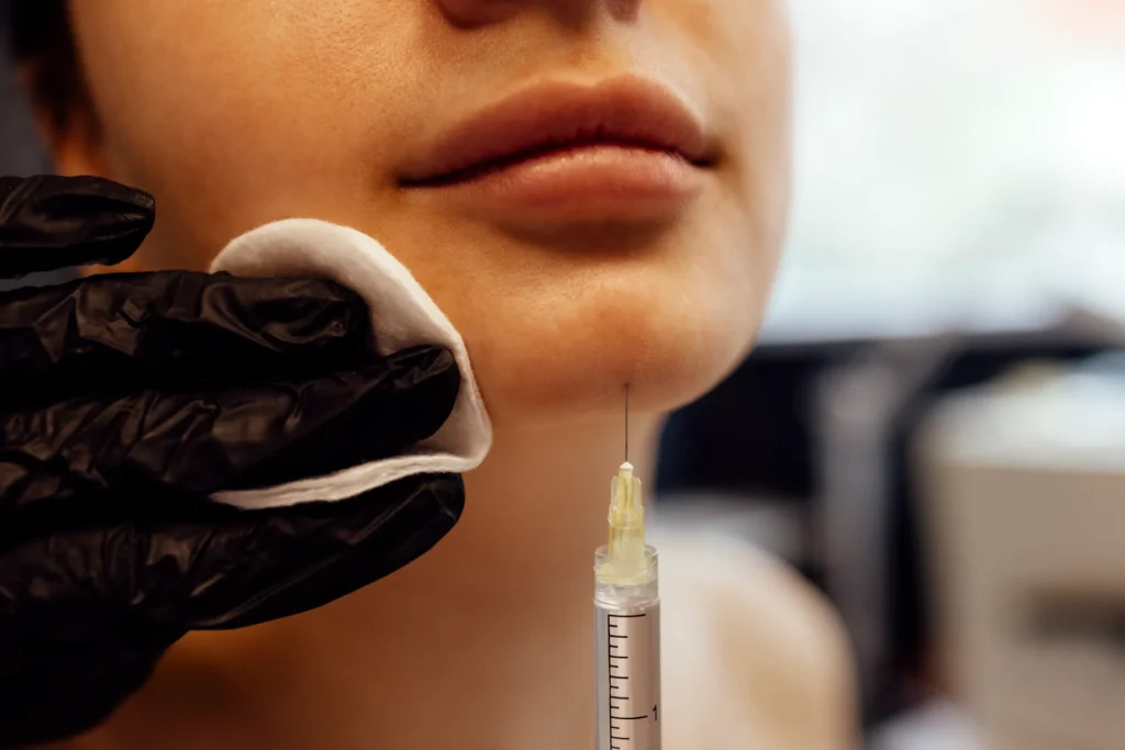 Chin Filler Tower Bridge Aesthetics Clinic 2