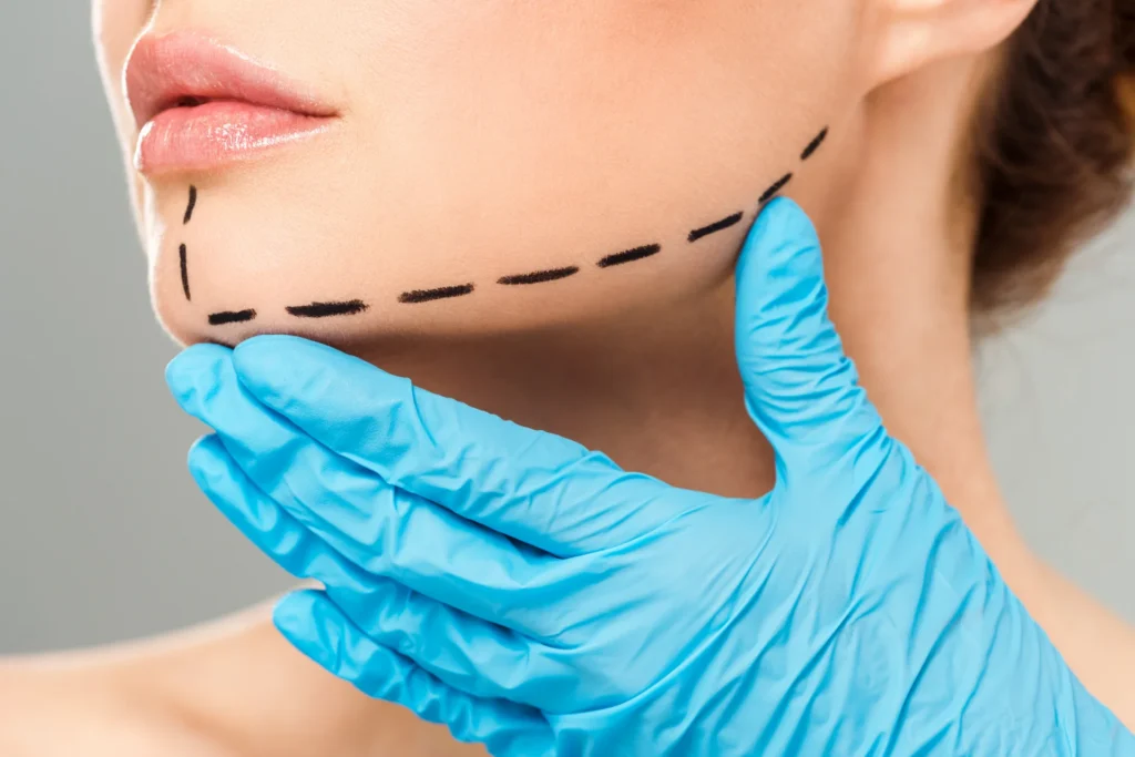 Jawline Filler Tower Bridge Aesthetics Clinic