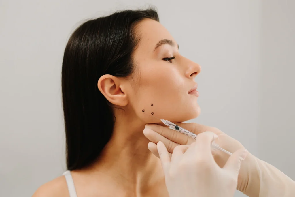 Jawline Filler Tower Bridge Aesthetics Clinic 2