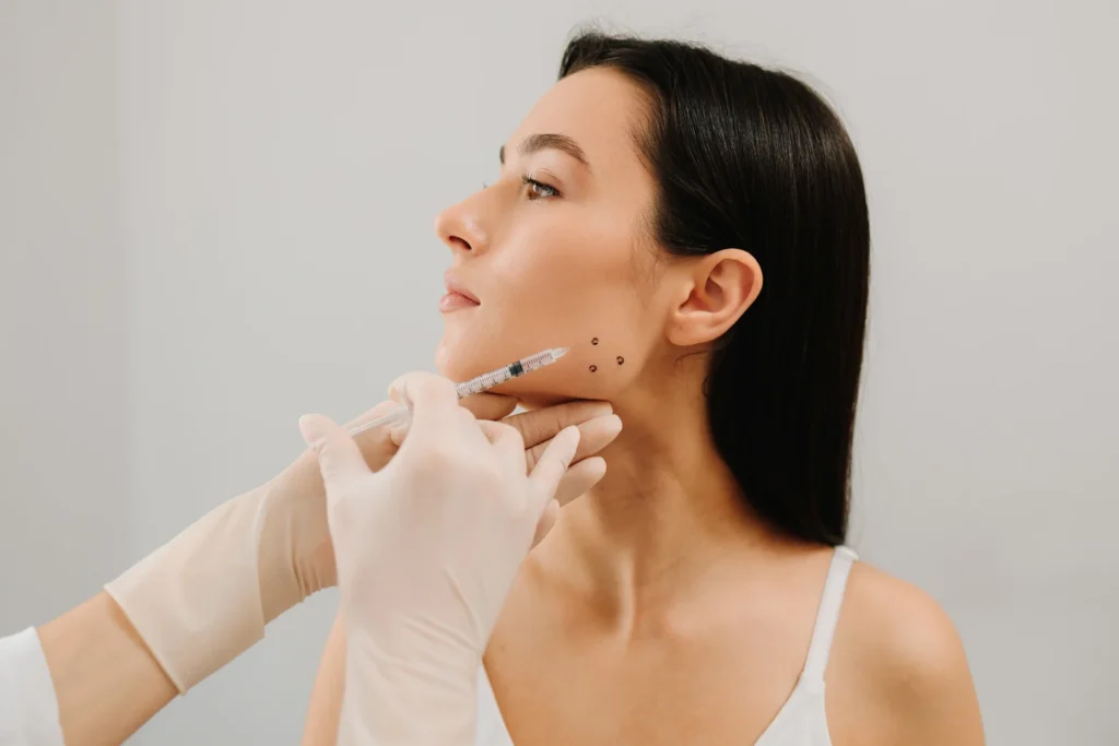 Jawline Filler Tower Bridge Aesthetics Clinic 4