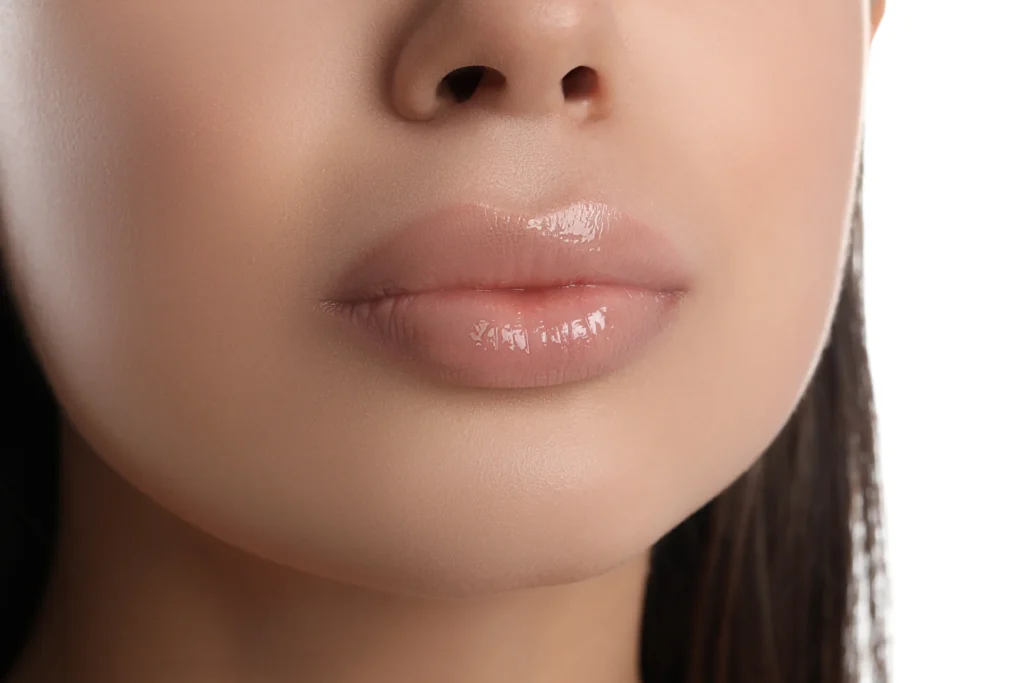 Lip Filler Tower Bridge Aesthetics Clinic 2