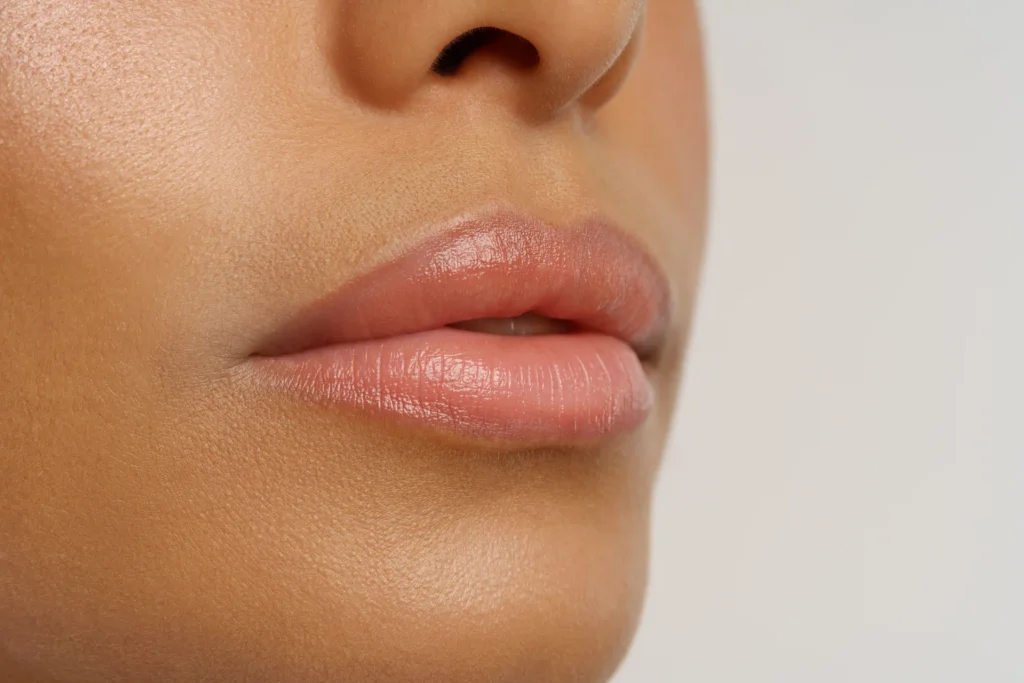 Lip Filler Tower Bridge Aesthetics Clinic 4