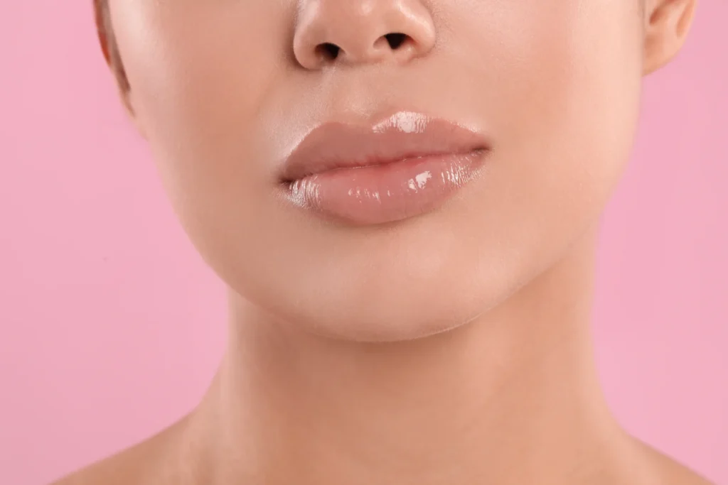 Lip Filler Tower Bridge Aesthetics Clinic 5