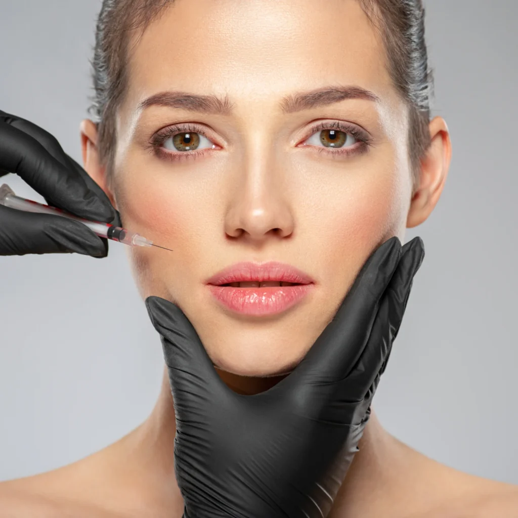 Nasolabial Fold Filler Tower Bridge Aesthetics Clinic 4